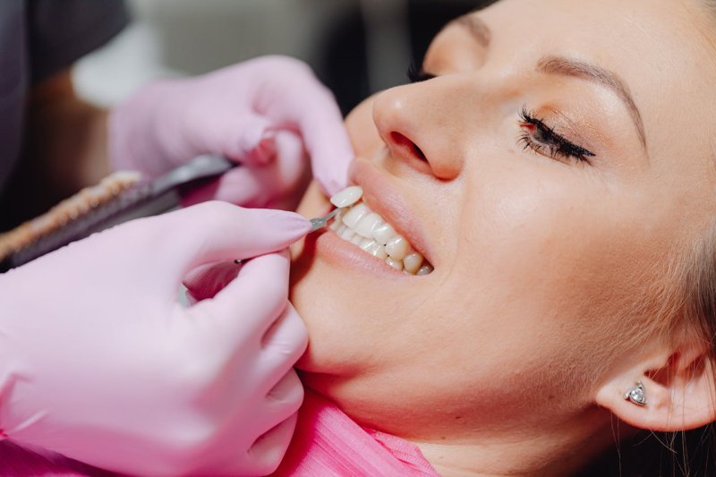 Laminate Dental Veneers